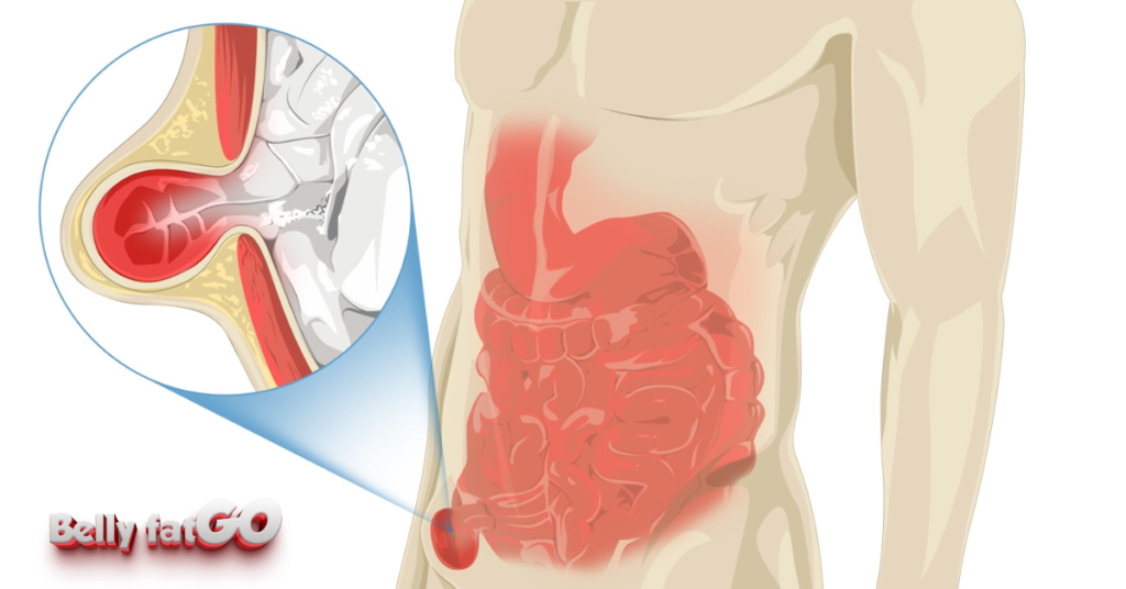 lose belly fat after hernia surgery